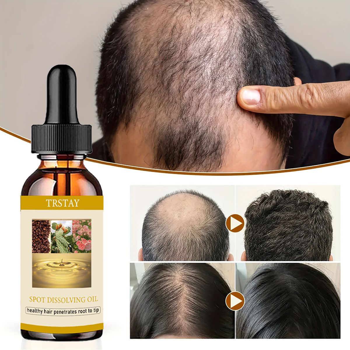 50ML 수염 성장 오일 남성 여성을 위한 탈모증 모발 - Beard Oil Growth 리뷰 및 가격