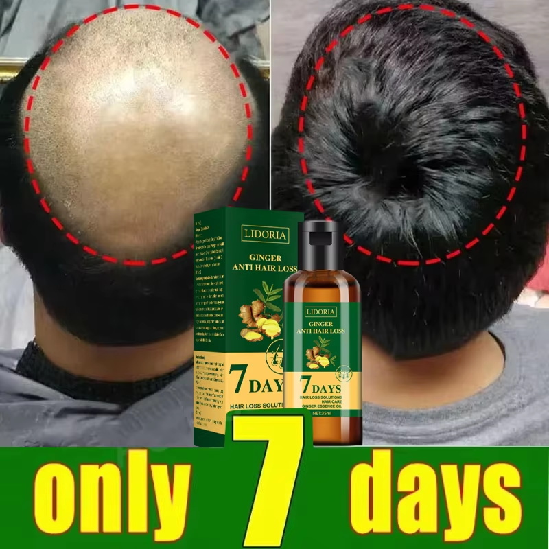 헤어 성장 세럼 7일 빠른 재성장 에센셜 캡슐 탈모 방 - Ingrown Hair Serum 리뷰 및 가격