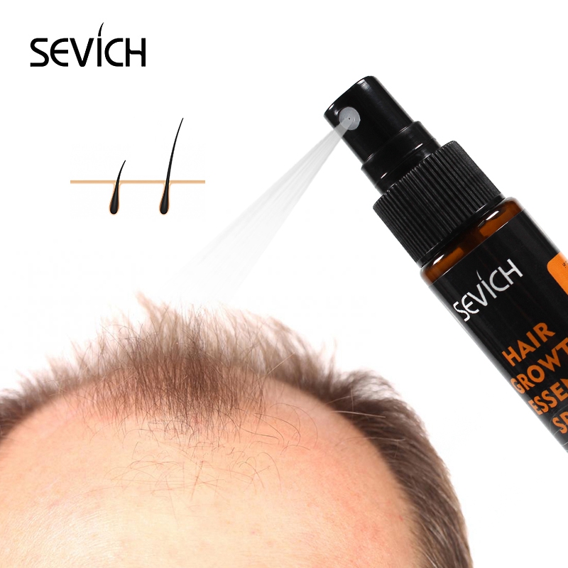Sevich 헤벌 오일 에센스, 빠른 모발 성장 스프레 - Beard Oil Growth 리뷰 및 가격